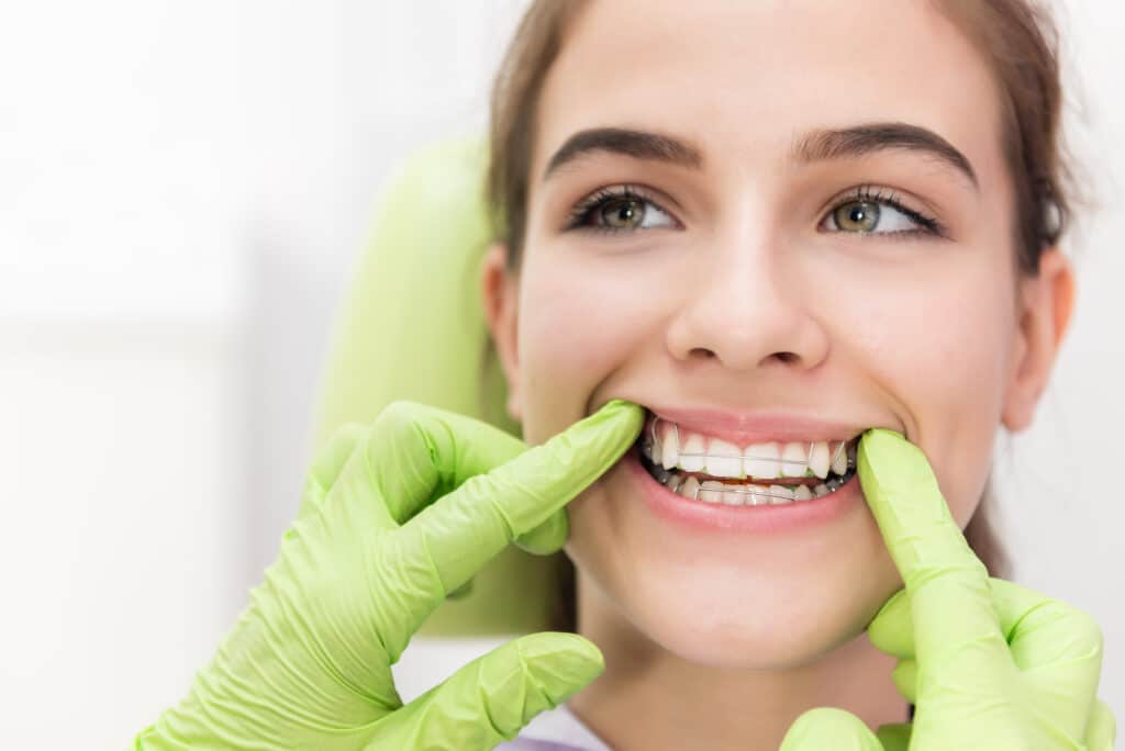 braces apple valley