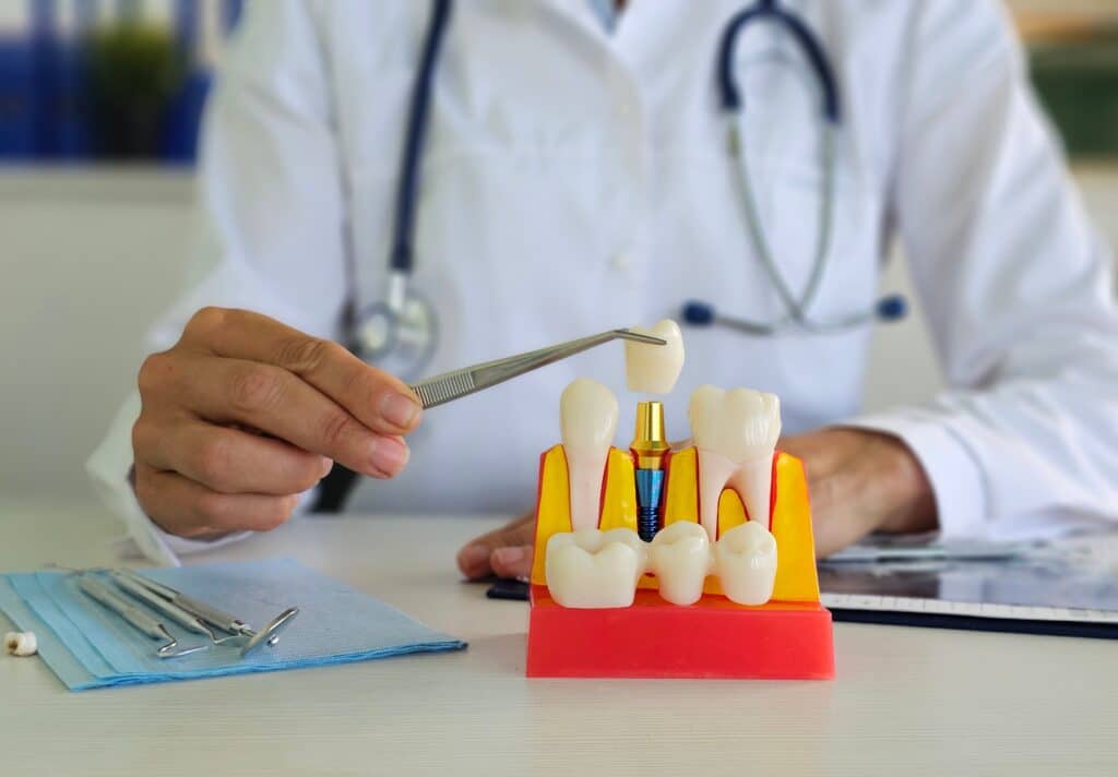 dental implant restoration apple valley