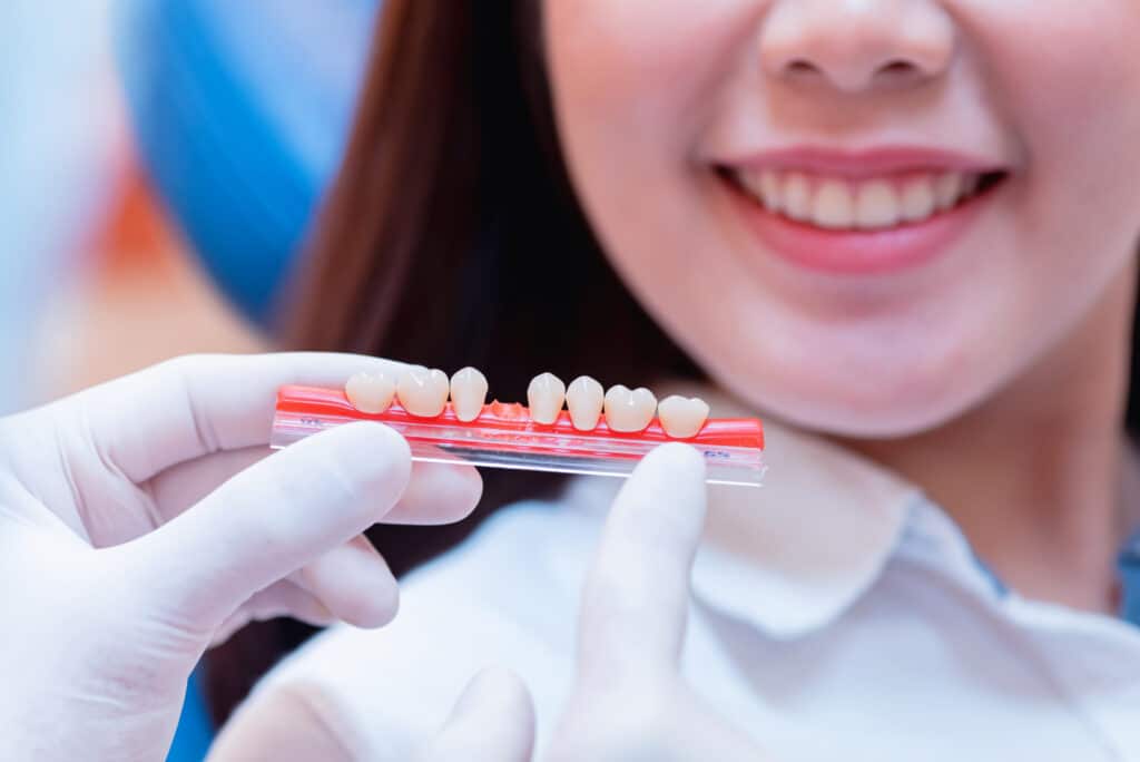 dental crowns apple valley