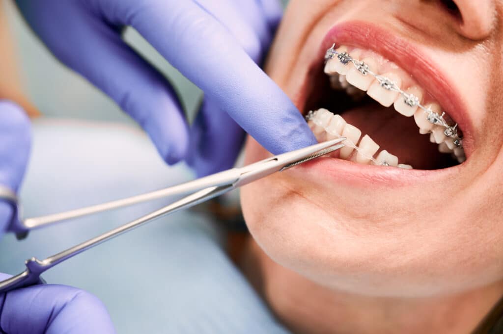 orthodontics apple valley