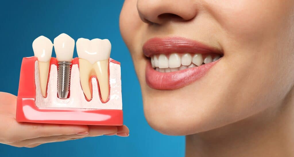 can you get dental implants with periodontal disease