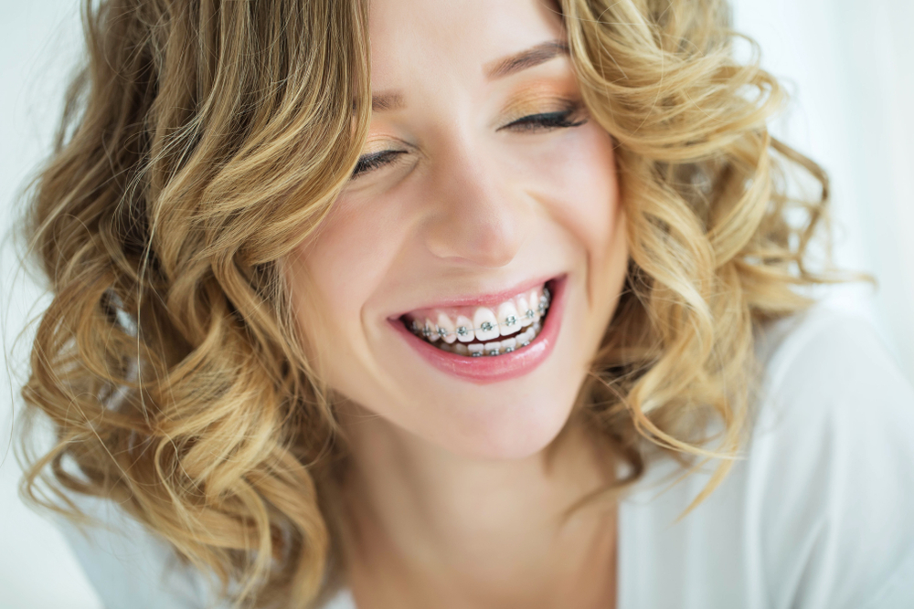 braces in Apple Valley